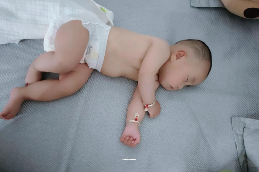 龙海六个月宝宝眼睛散光